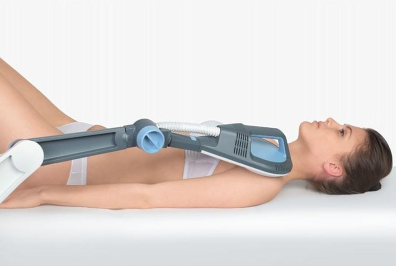 Sistema súper inductivo, SIS