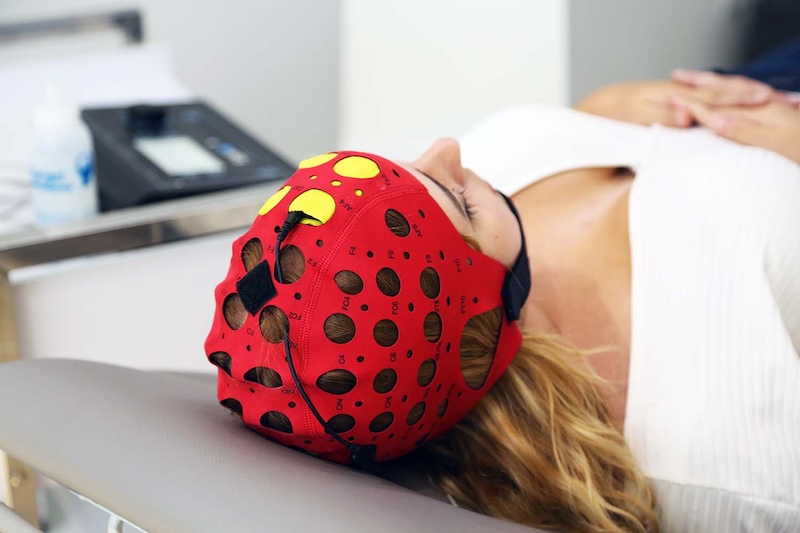 Estimulación Transcraneal Corriente Directa TDCS